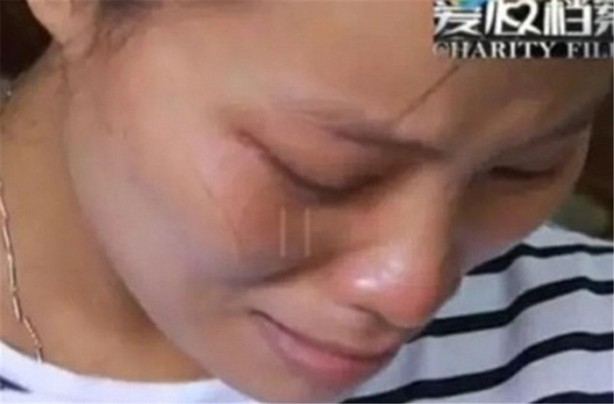 Foto - Gözleri olmadan doğdu!