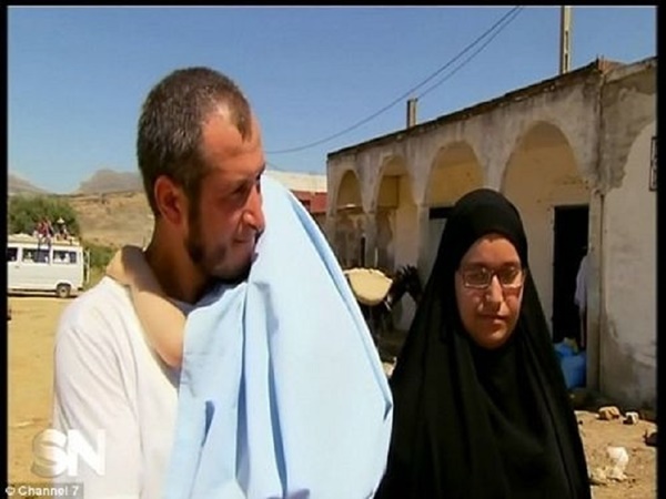 Foto - Gözleri ve burnu olmadan doğdu