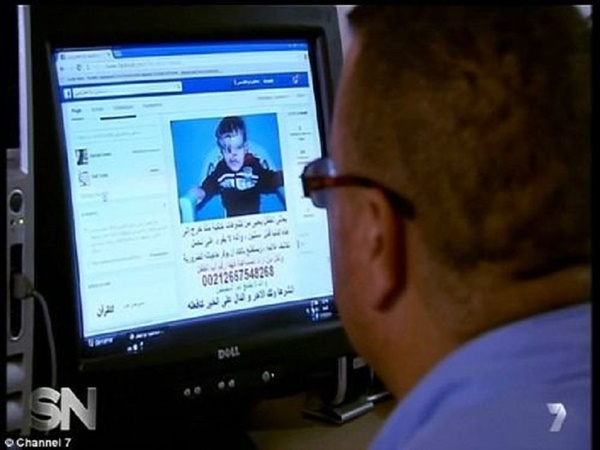 Foto - Gözleri ve burnu olmadan doğdu