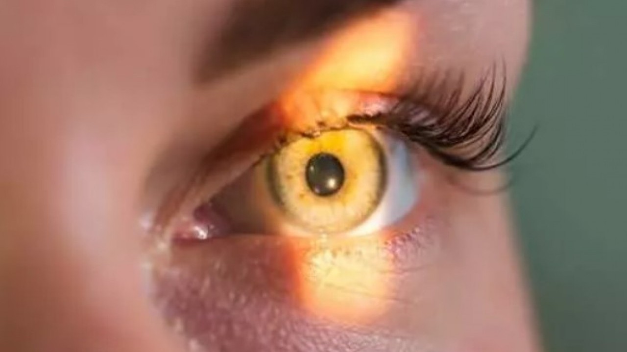 Foto - Gözlük kullanırken bu hatayı sakın yapmayın: Sarı nokta hastalığına sebep oluyor!