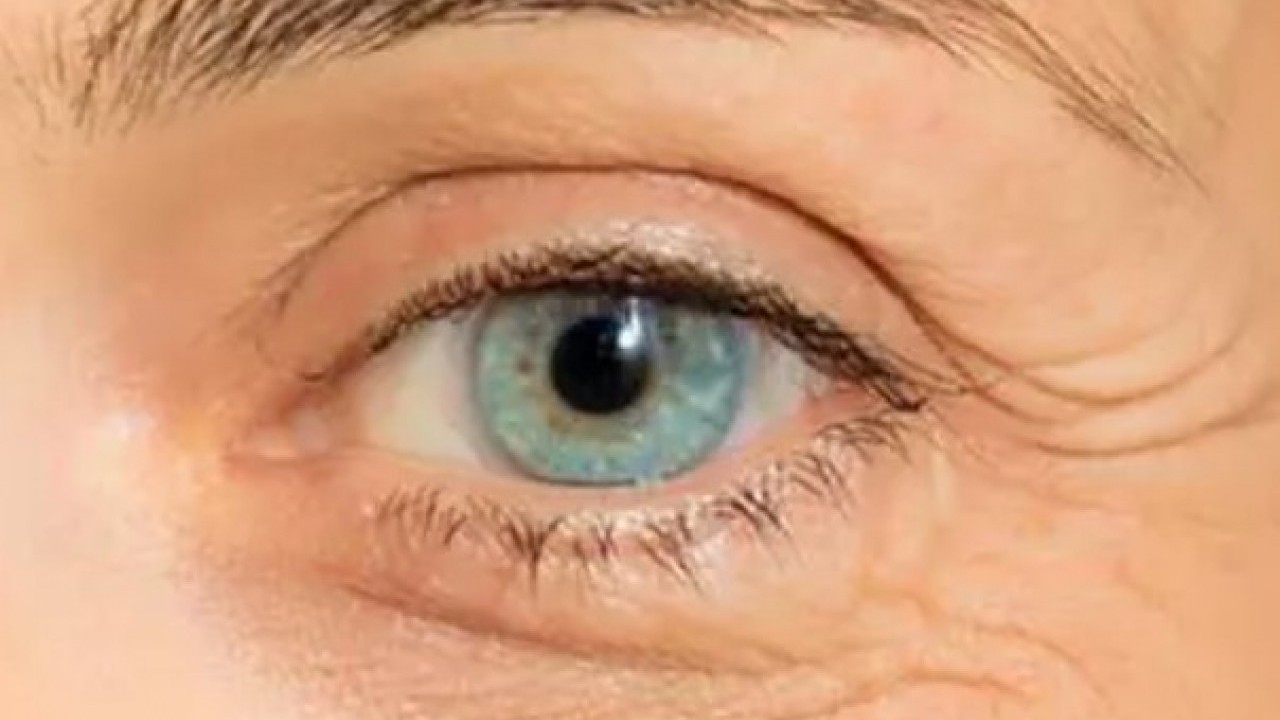 Foto - Gözlük kullanırken bu hatayı sakın yapmayın: Sarı nokta hastalığına sebep oluyor!