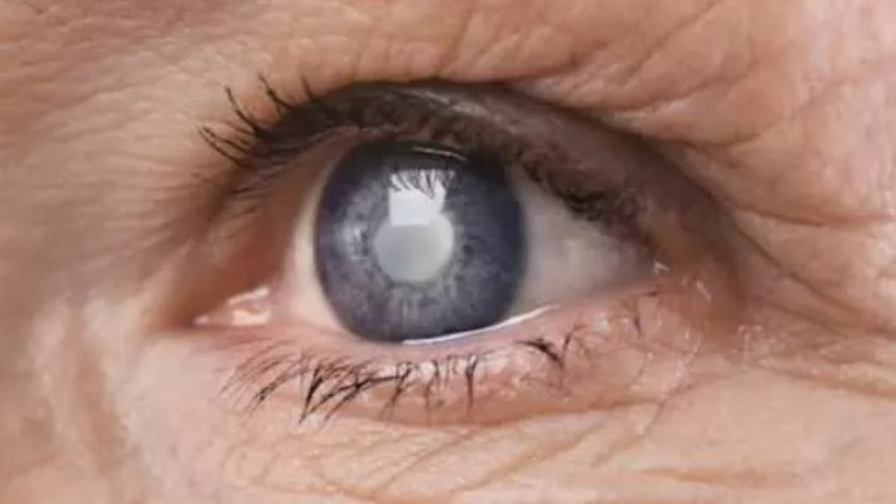 Foto - Gözlük kullanırken bu hatayı sakın yapmayın: Sarı nokta hastalığına sebep oluyor!