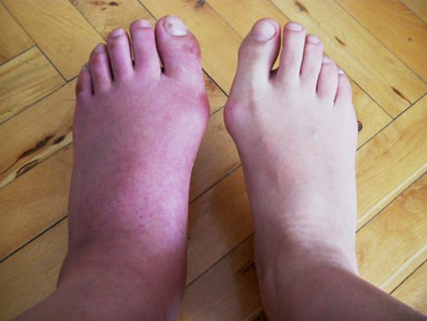 Foto - Gözlük vidanız çabuk çıkıyorsa...