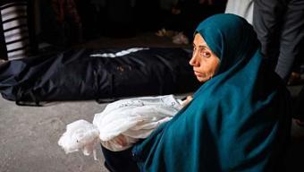 Foto - Gözümüzün içine baka baka 'SOYKIRIM!' İsrail insanları diri diri yaktı!