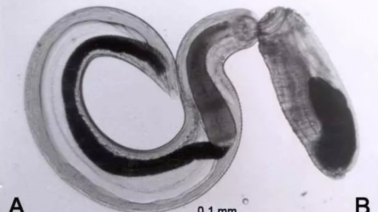Foto - Gözünden çıkana doktorlar inanamadı: 8 ay farketmeden yaşamış!