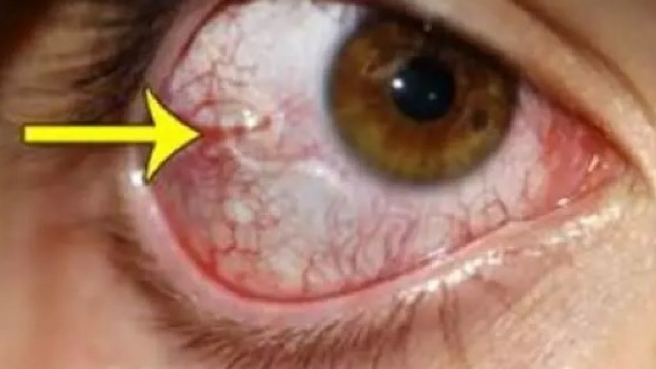 Foto - Gözünden çıkana doktorlar inanamadı: 8 ay farketmeden yaşamış!