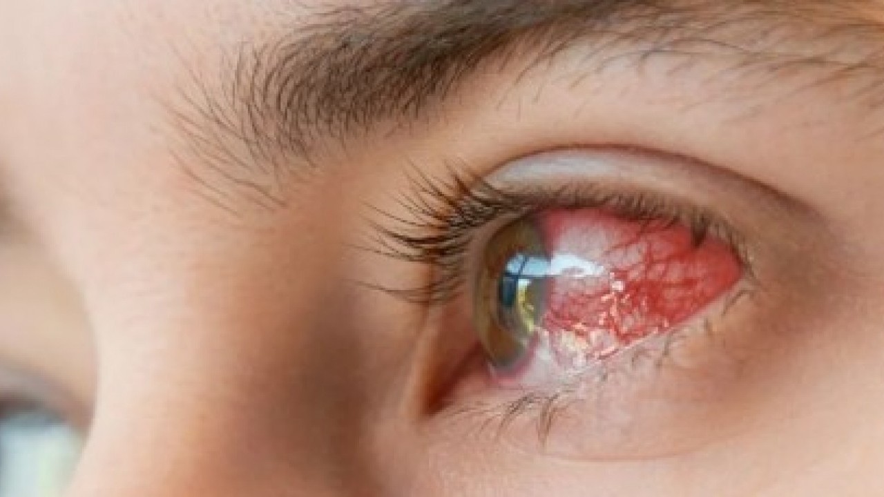 Foto - Gözünden çıkana doktorlar inanamadı: 8 ay farketmeden yaşamış!