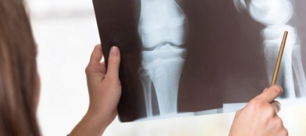 Foto - Güçlü kemikler için...