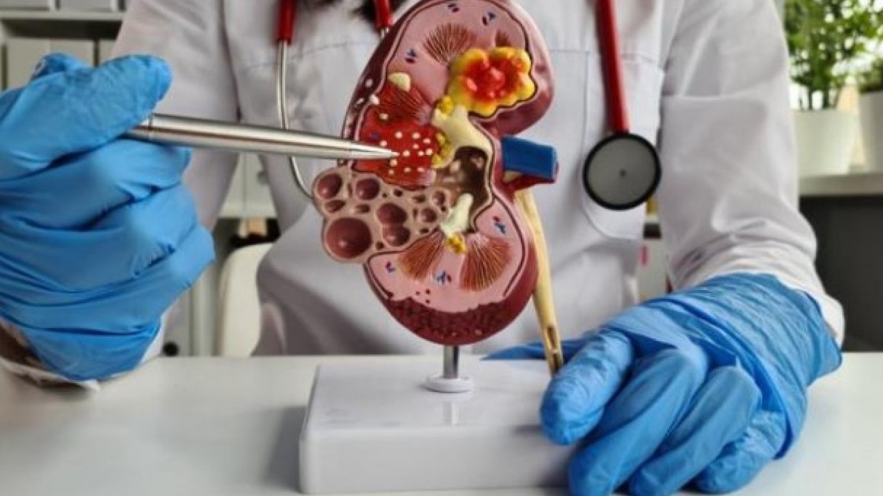 Gün geçtikçe böbreklerimizi bitiyor! İşte farkında olmadan yaptığımız yanlışlar