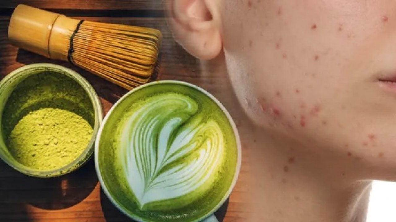 Foto - Günde 4 bardak matcha çayı içiyordu: Belirtiler alarm verdi! O sorunu görenler inanamadı... Bakın neler çıktı