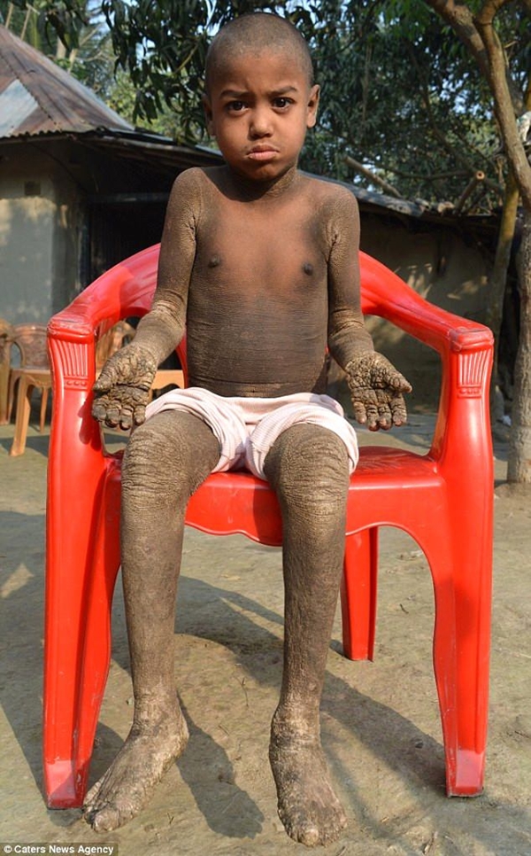 Foto - Günden güne taşa dönüşüyor!