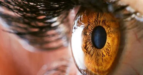 Foto - Güneş gözlüğü kullananlar dikkat! Eğer bu olmazsa kornea yanığı olabilir