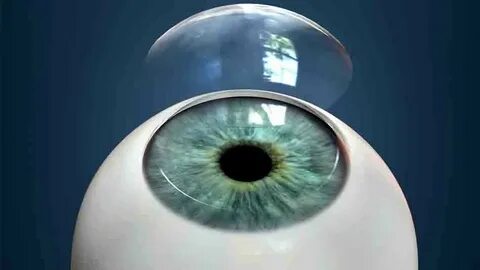 Foto - Güneş gözlüğü kullananlar dikkat! Eğer bu olmazsa kornea yanığı olabilir