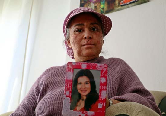 Foto - Güneşe çıkınca eriyor! Yaz mevsimi kabusu oldu