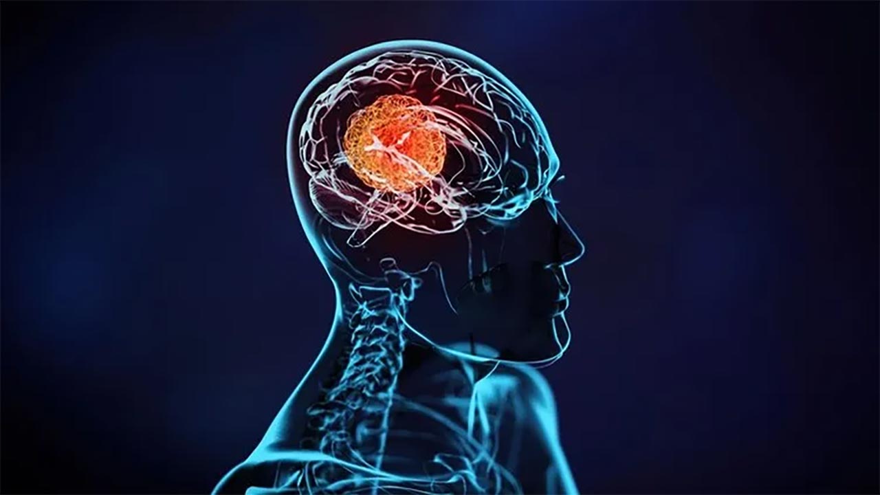 Foto - Günler içinde B12 eksikliğini bitiriyor! Beyni füze gibi çalıştıran o besin...