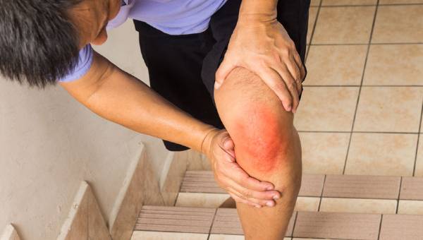 Foto - Gut hastalığına yol açan Ürik asidi azaltmanın yolları