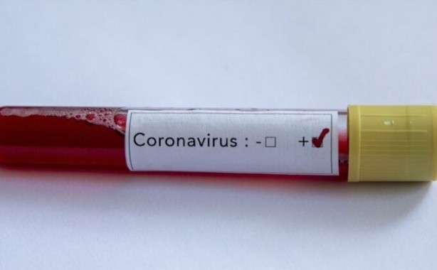 Foto - Güzel haber geldi! Koronavirüse karşı ilaç bulundu