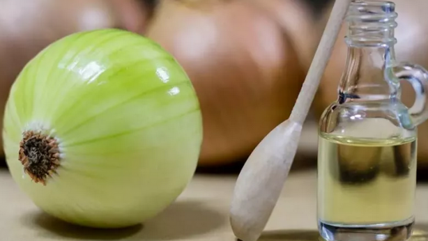 Güzel ve sağlıklı saçlar için soğan suyu: Saç dökülmesi olanlar, nasıl kurtulurum diyenler... İşte bu kadar kolay