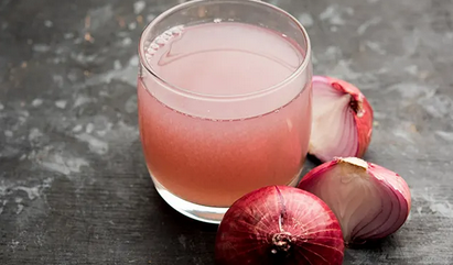 Foto - Güzel ve sağlıklı saçlar için soğan suyu: Saç dökülmesi olanlar, nasıl kurtulurum diyenler... İşte bu kadar kolay