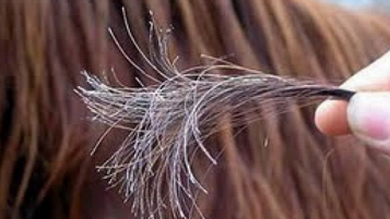 Foto - Güzel ve uzun saçlara sahip olabileceğiniz doğal yöntemler: Gür saçlara sahip olmanın sırrı! İşte inanılmaz bir...