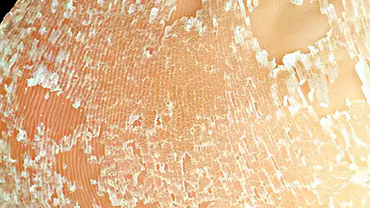 Foto - Güzellik uğruna yara eden var! Çatlayan topuk böyle iyileşiyor… O acılar teker teker düşecek…