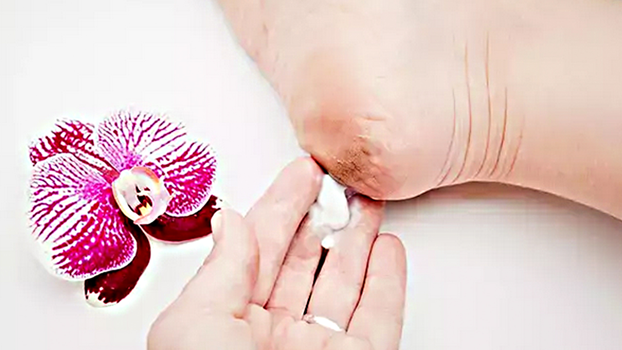 Foto - Güzellik uğruna yara eden var! Çatlayan topuk böyle iyileşiyor… O acılar teker teker düşecek…