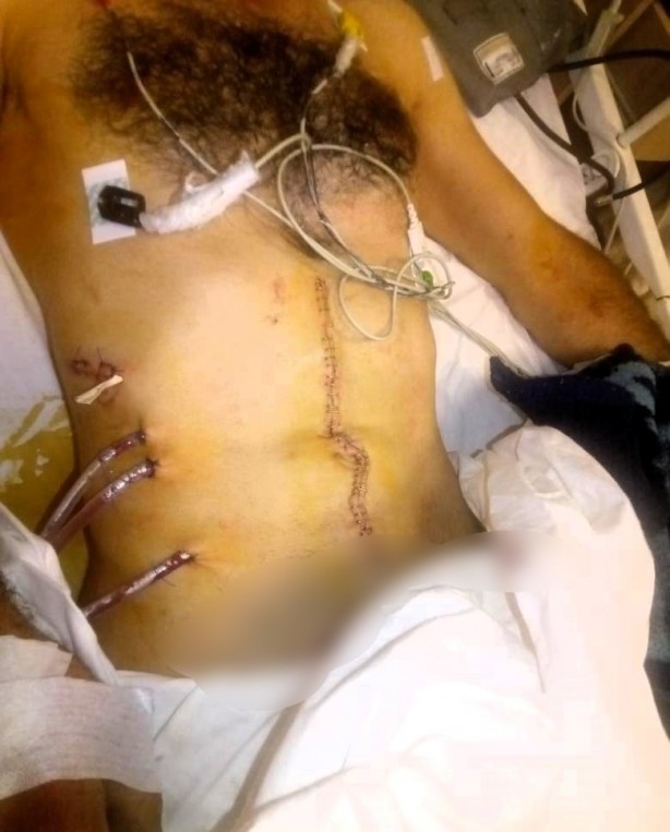 Foto - Habere yapılan yorumu beğenmeyen muhtar adayı dehşet saçtı!