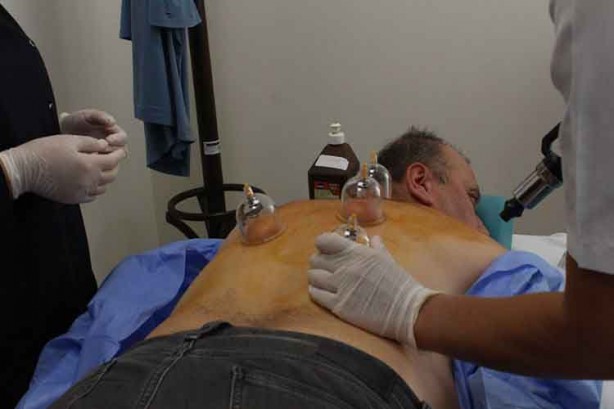 Foto - Hacamat nedir? Nasıl yapılır? Faydaları ve hangi hastalıklara iyi gelir?