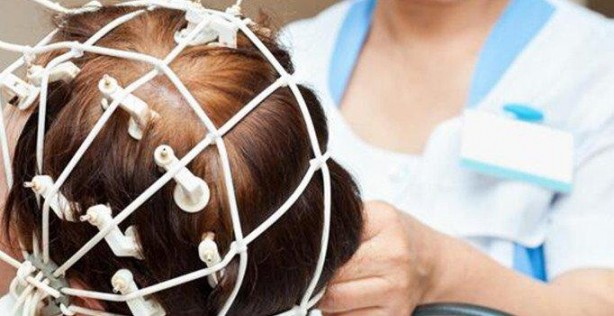 Foto - Hafıza silmek gerçekten mümkün mü? Tıp dünyası 'hafıza silme'nin yollarını arıyor 