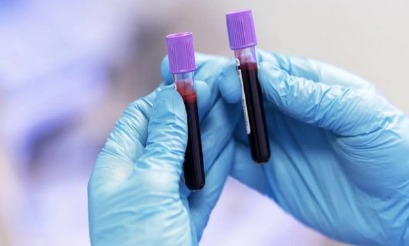 Foto - Hangi kan grubunda olanlar daha uzun yaşıyor? Araştırmayla ortaya çıkan gerçek: uzmanlar şaşkın!