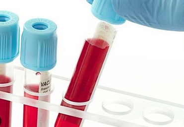 Foto - Hangi kan grubunda olanlar daha uzun yaşıyor? Araştırmayla ortaya çıkan gerçek: uzmanlar şaşkın!