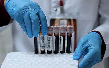 Foto - Hangi kan grubunda olanlar daha uzun yaşıyor? Araştırmayla ortaya çıkan gerçek: uzmanlar şaşkın!