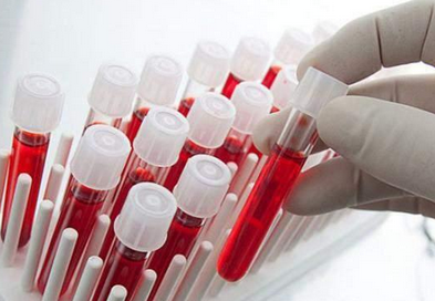 Foto - Hangi kan grubunda olanlar daha uzun yaşıyor? Araştırmayla ortaya çıkan gerçek: uzmanlar şaşkın!