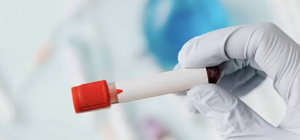 Foto - Hangi kan grubunda olanlar daha uzun yaşıyor? Araştırmayla ortaya çıkan gerçek: uzmanlar şaşkın!