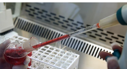 Foto - Hangi kan grubunda olanlar daha uzun yaşıyor? Araştırmayla ortaya çıkan gerçek: uzmanlar şaşkın!