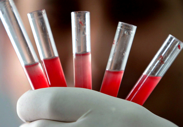 Foto - Hangi kan grubunda olanlar daha uzun yaşıyor? Araştırmayla ortaya çıkan gerçek: uzmanlar şaşkın!