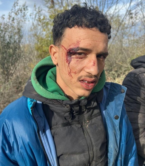 Foto - Hani nerede insan hakları? Yunan işkencesi