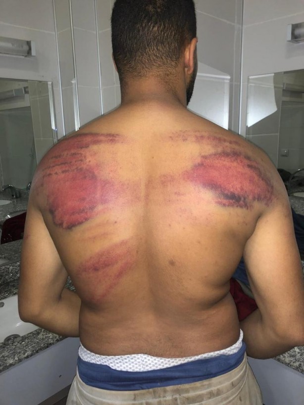 Foto - Hani nerede insan hakları? Yunan işkencesi