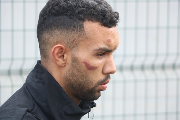 Foto - Hani nerede insan hakları? Yunan işkencesi