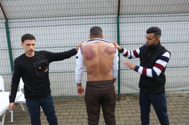 Foto - Hani nerede insan hakları? Yunan işkencesi