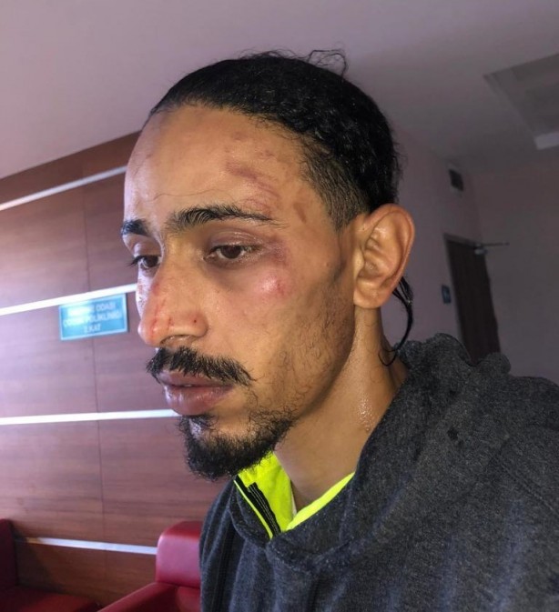 Foto - Hani nerede insan hakları? Yunan işkencesi