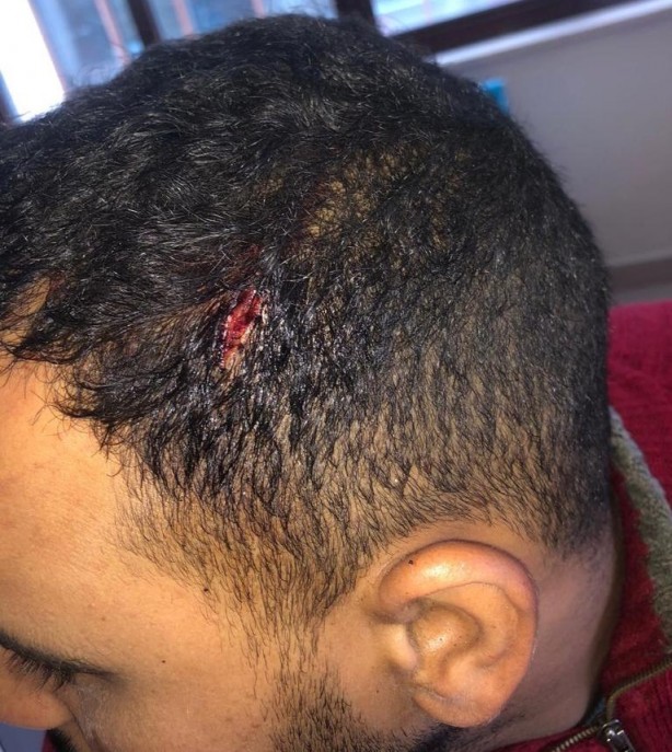 Foto - Hani nerede insan hakları? Yunan işkencesi