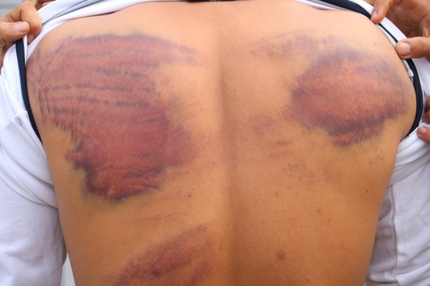 Hani nerede insan hakları? Yunan işkencesi