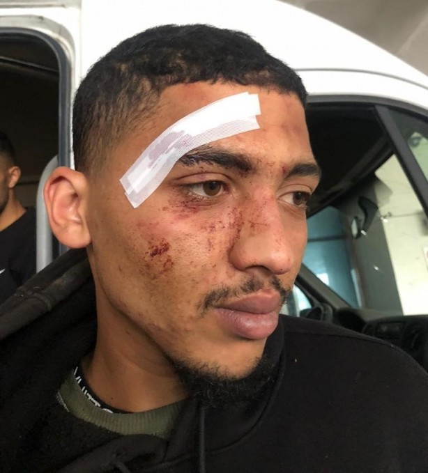 Foto - Hani nerede insan hakları? Yunan işkencesi