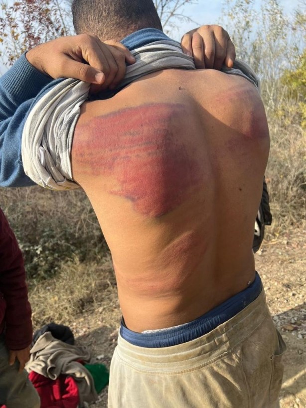 Foto - Hani nerede insan hakları? Yunan işkencesi