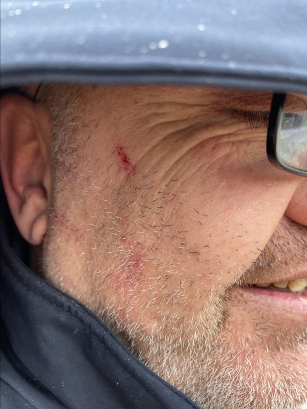 Foto - Hasta taşıyan ambulansın şoförü darbedildi