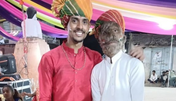 Foto - Hastalığı dünyasını altüst etti! 'Kurt Adam'a dönüştü