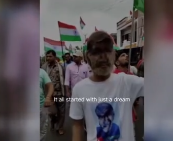 Foto - Hastalığı dünyasını altüst etti! 'Kurt Adam'a dönüştü