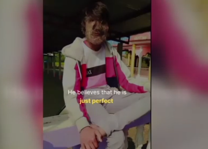 Foto - Hastalığı dünyasını altüst etti! 'Kurt Adam'a dönüştü