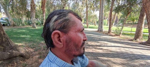 Foto - Hastalığı yüzünden insanlar ondan kaçıyor